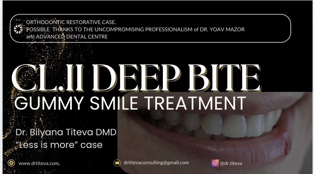 По време на ортодонтския конгрес на GC в София имай ограничено време да представя този интересен клиничен случай, затова направих подробно разглеждане на всички специфики на избора ми за протокол с порцеланови самолигиращи брекети и термоактивни дъги с памет за предвидими резултати.  Вижте в подробности моя протокол за ежедневна работа. Д-р Титева